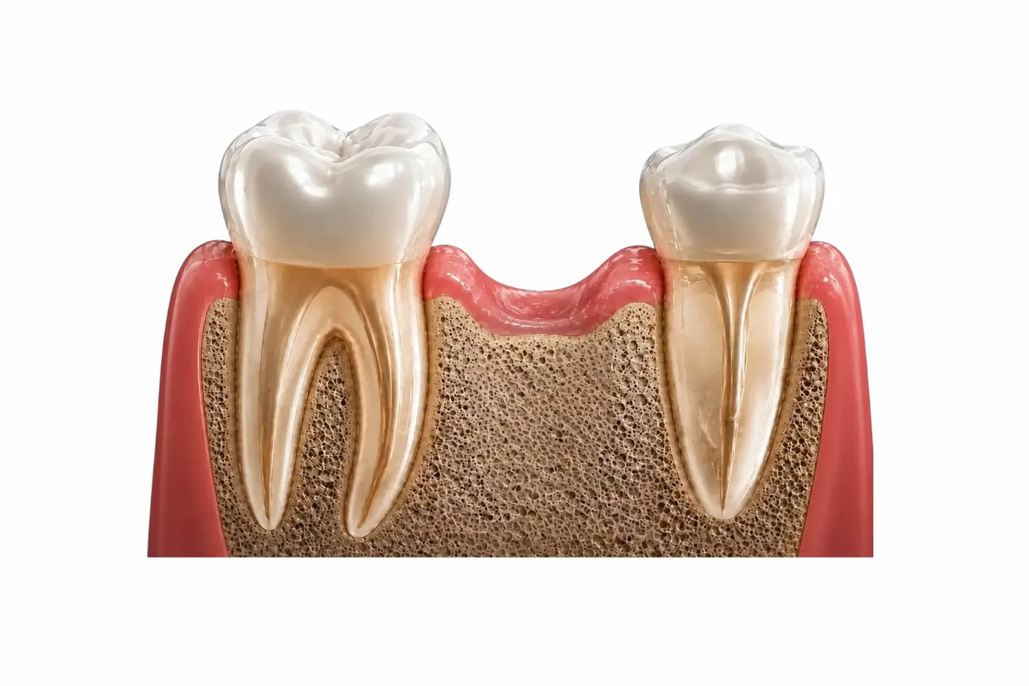 Missing tooth area before dental implant treatment in Tijuana